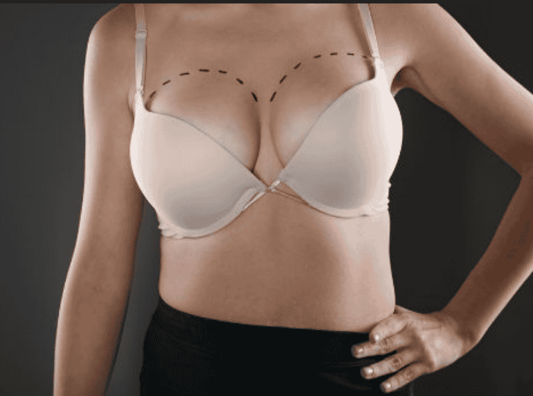 Asymmetric Breasts